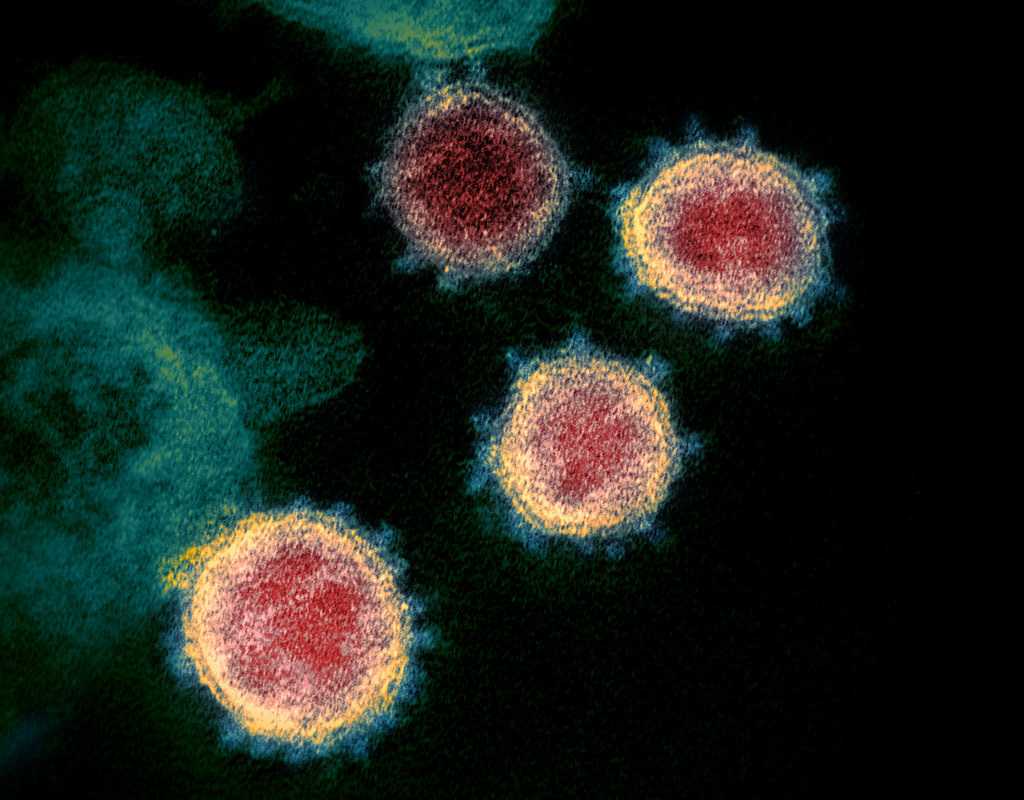 alimentacion para no enfermarse de coronavirus - Dra Tania Ayala